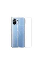 Uray store Xiaomi Mi 11 Kılıf Lüx Şeffaf Silikon - Görsel 2