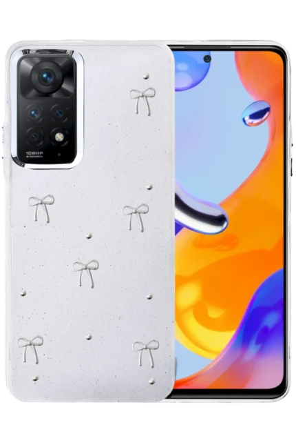 Uray store Xiaomi Redmi Note 11 Pro Fiyonk Desenli Kapak - Desen 5
