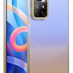 Uray store Xiaomi Redmi Note 11 Pro Glossy Kapak - Çöl Titanyum