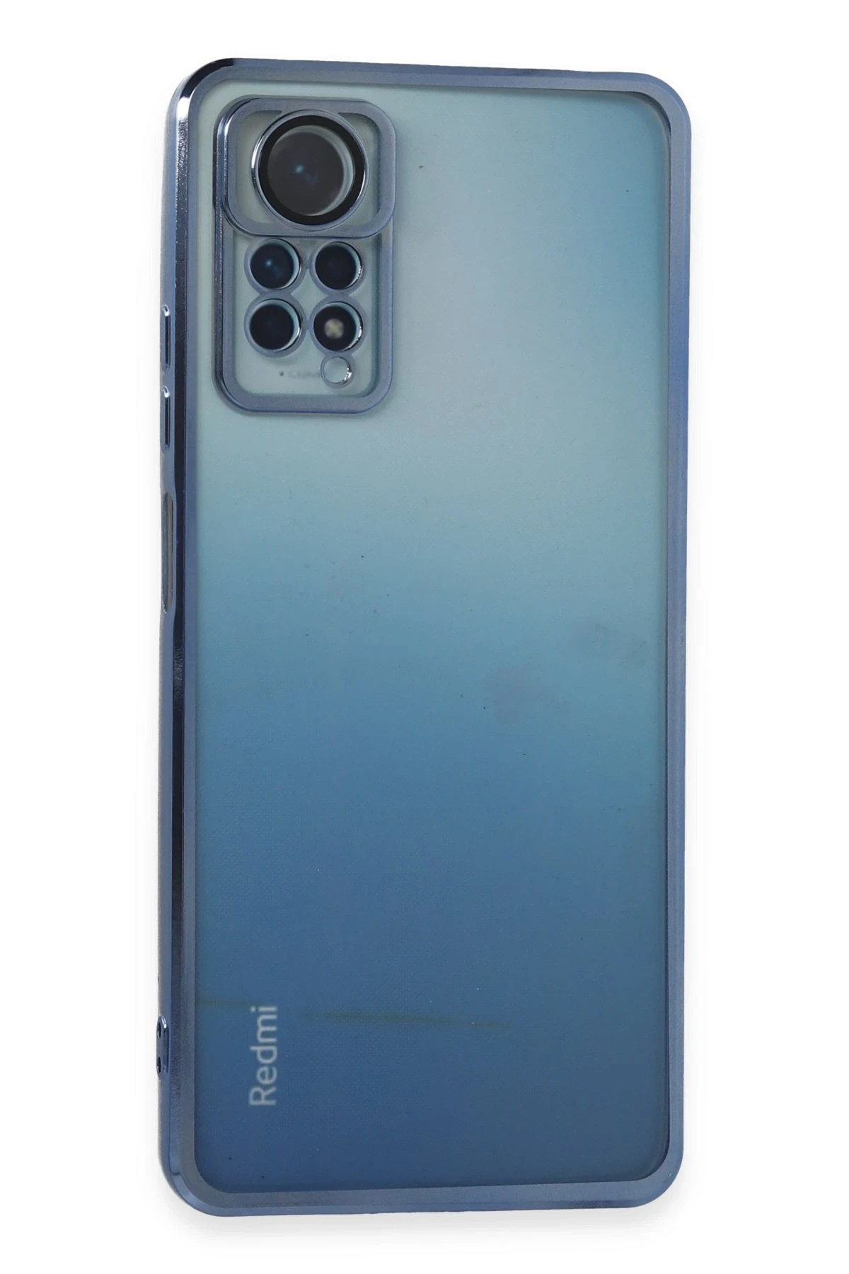 newface-xiaomi-redmi-note-11-pro-kilif-razer-lensli-silikon-acik-mavi-default Uray store Xiaomi Redmi Note 11 Pro Kılıf Razer Lensli Silikon - Açık Mavi - Görsel 1
