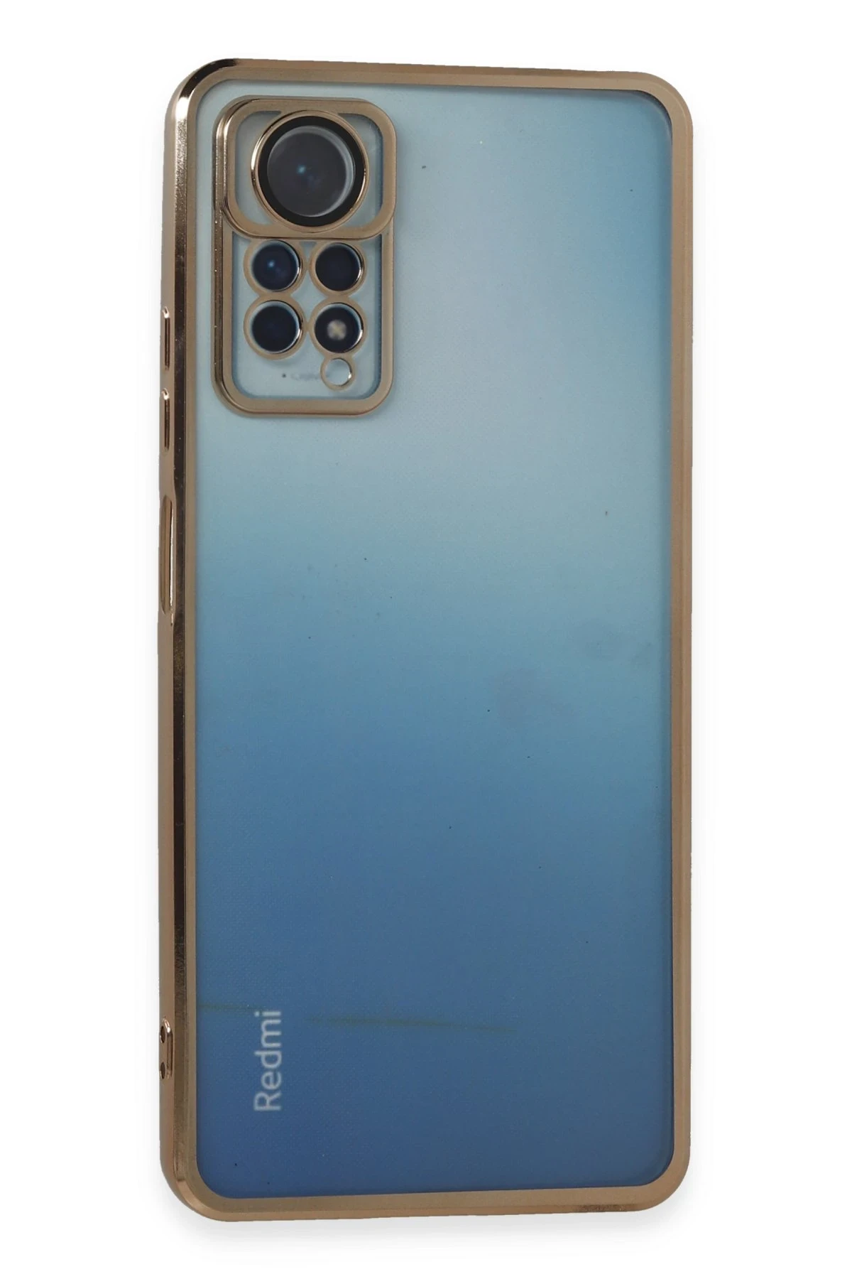 newface-xiaomi-redmi-note-11-pro-kilif-razer-lensli-silikon-gold-default Uray store Xiaomi Redmi Note 11 Pro Kılıf Razer Lensli Silikon - Gold - Görsel 1