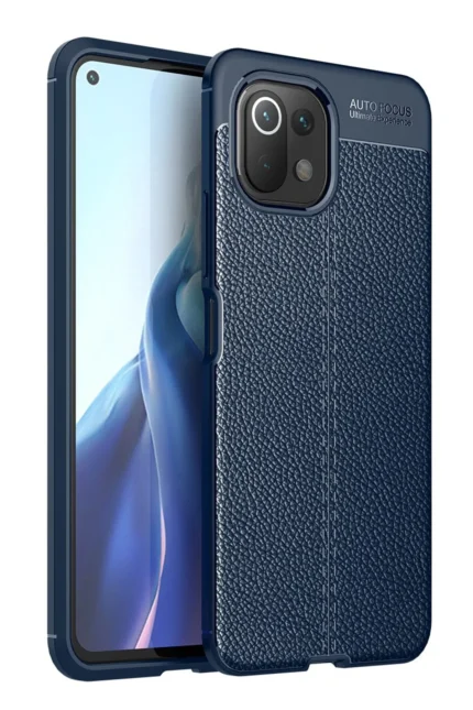 Uray store Xiaomi Mİ 11 Lite Kılıf Auto Focus Kapak - Lacivert