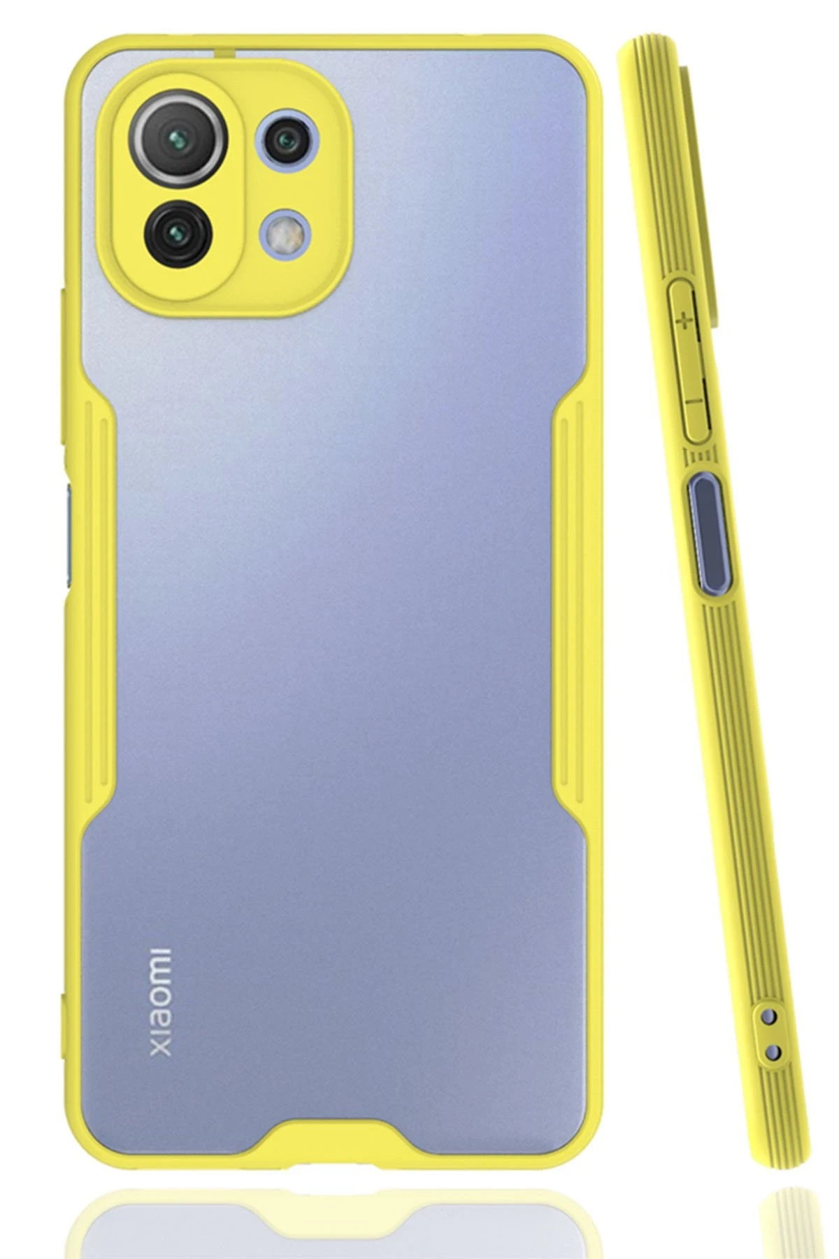 newface-xiaomi-mi-11-lite-kilif-platin-silikon-sari-default Uray store Xiaomi Mİ 11 Lite Kılıf Platin Silikon - Sarı - Görsel 1